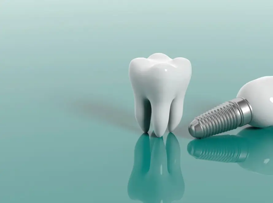 en-iyi-implant-markaları