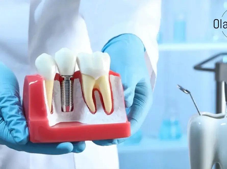 seramik implant nedir kimler için uygundur